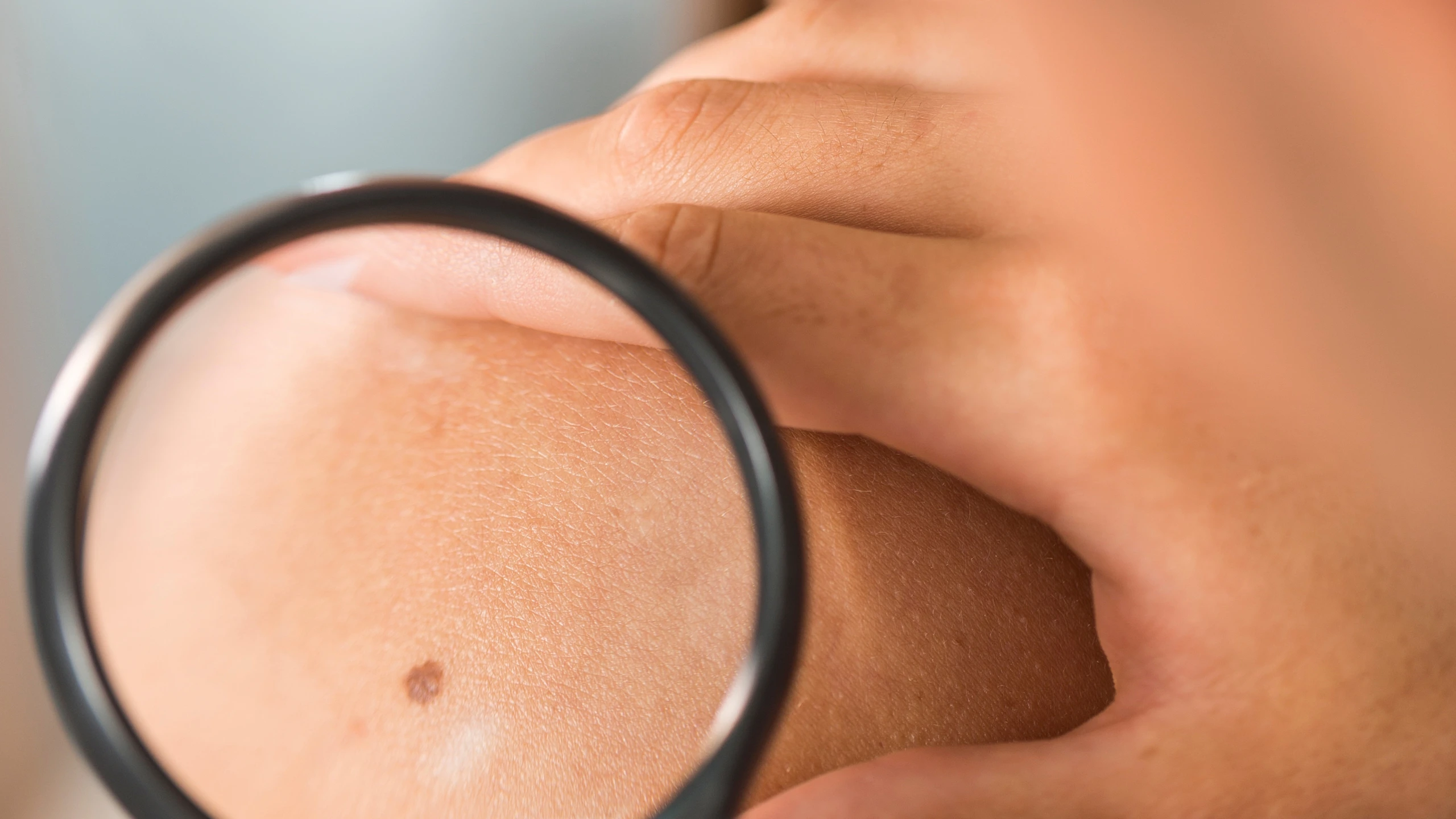 Chloe-Delhomme-Centre-Dermatologique-Nancy